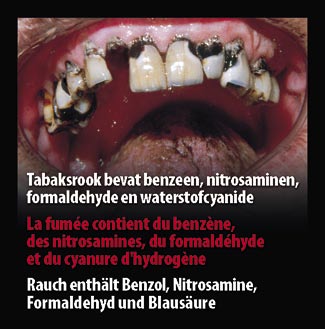 Belgium 2007 Consituents - diseased organ, benzene, nitrosamines, formaldehyde, hydrogen cyanide